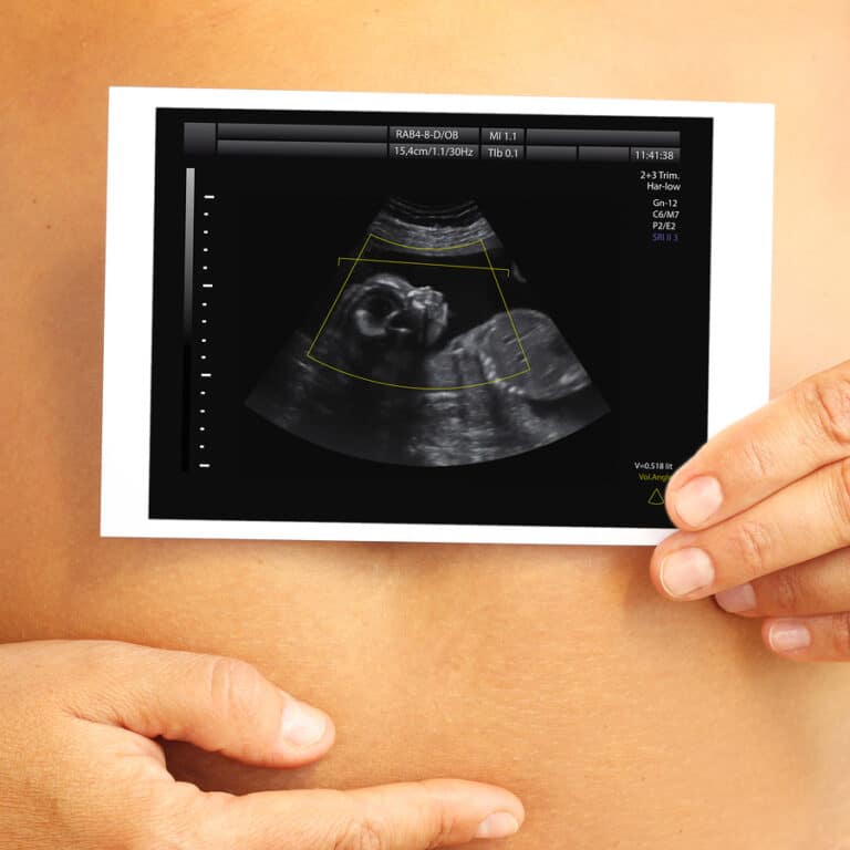 Surrogacy Modern Family Planning Technologies and the Law